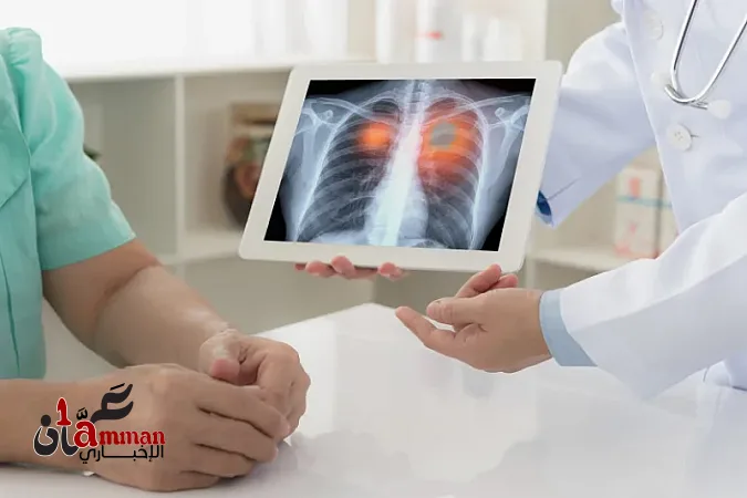 لماذا يُصاب بعض المدخنين بالسرطان وينجو آخرون؟