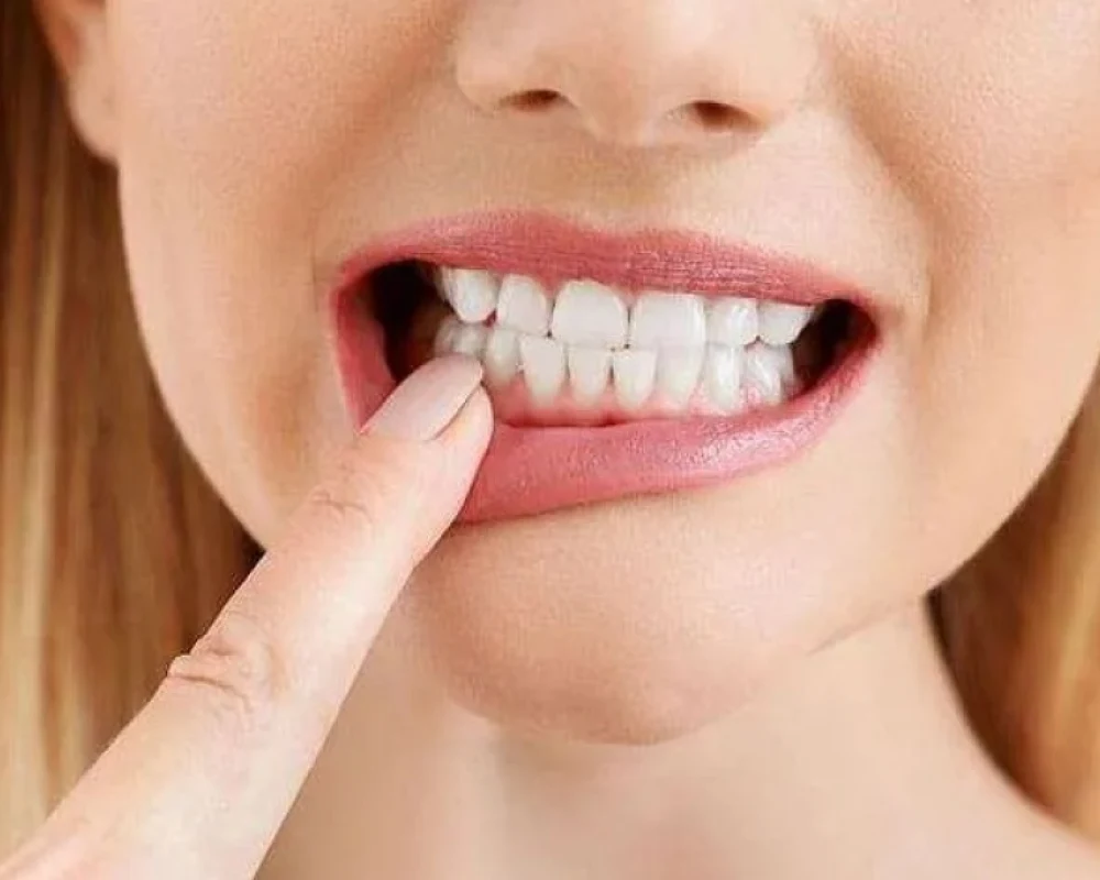 وداعاً للتسوس.. علماء يكتشفون طريقة لإعادة نمو مينا الأسنان
