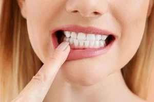 وداعاً للتسوس.. علماء يكتشفون طريقة لإعادة نمو مينا الأسنان