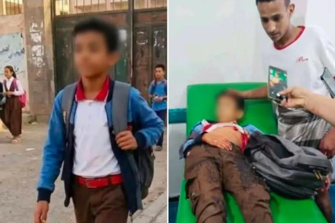 مقتل طفل قنصا بتعز يهز المنصات ومغردون يتهمون الحوثيين